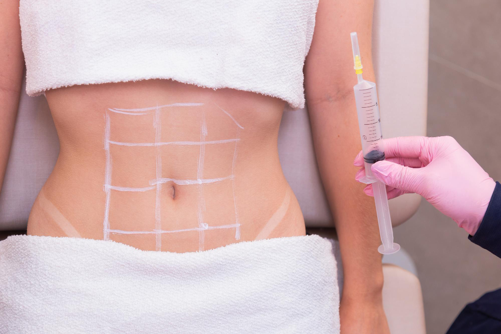 A Comprehensive Guide to Types of Liquid Liposuction