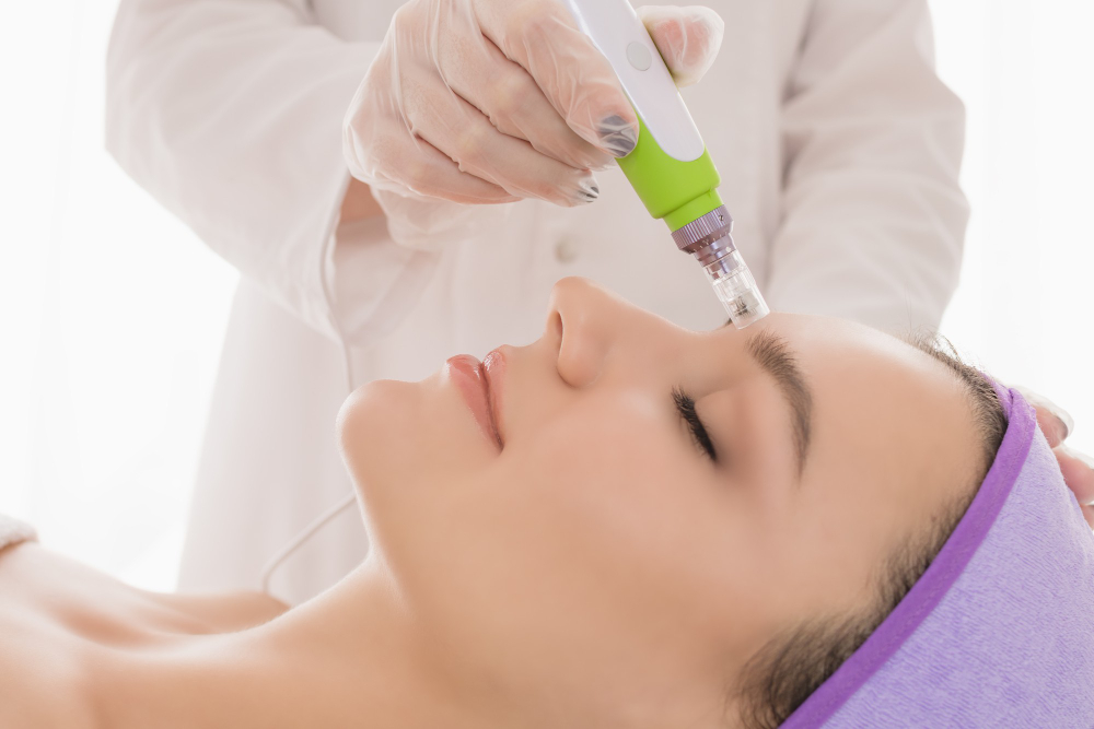 Discover the Benefits of Microneedling for Scars and Uneven Skin Tone