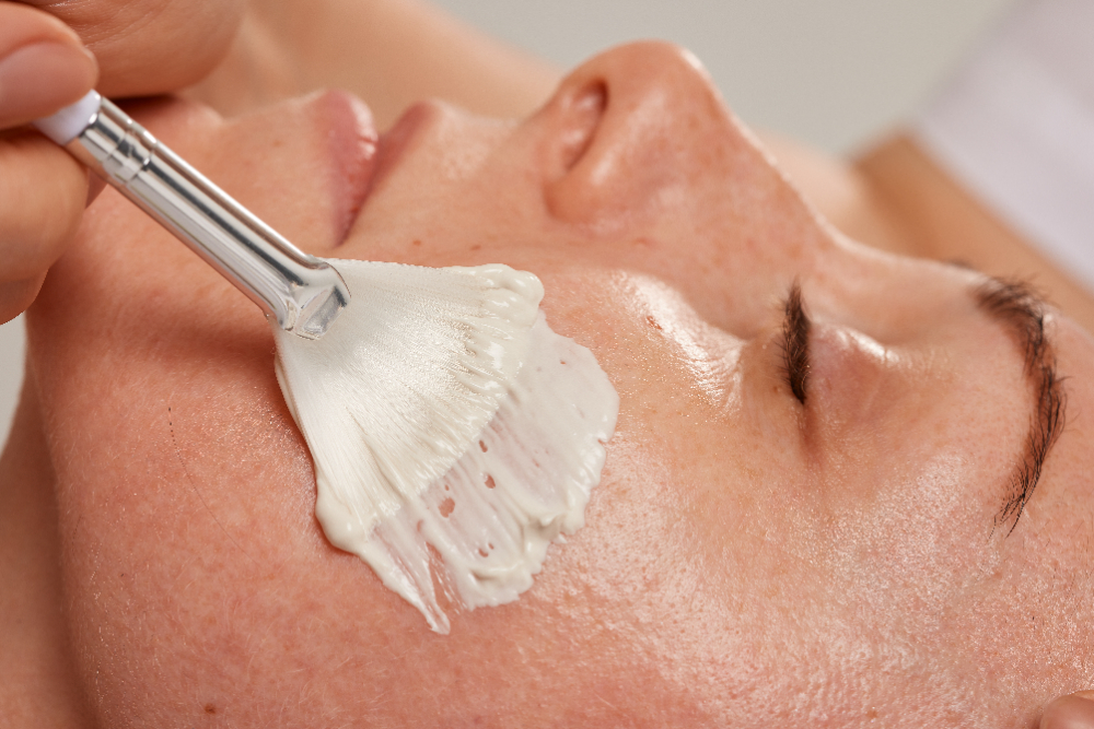 What to Expect Before You Get a Chemical Peel