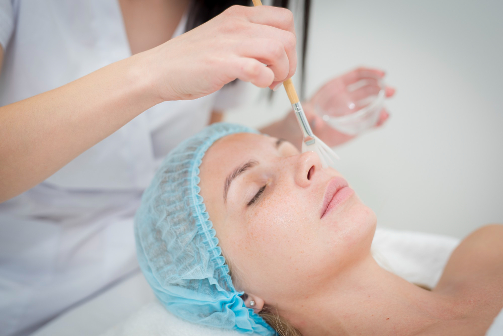 How Chemical Peels Can Help Treat Hyperpigmentation