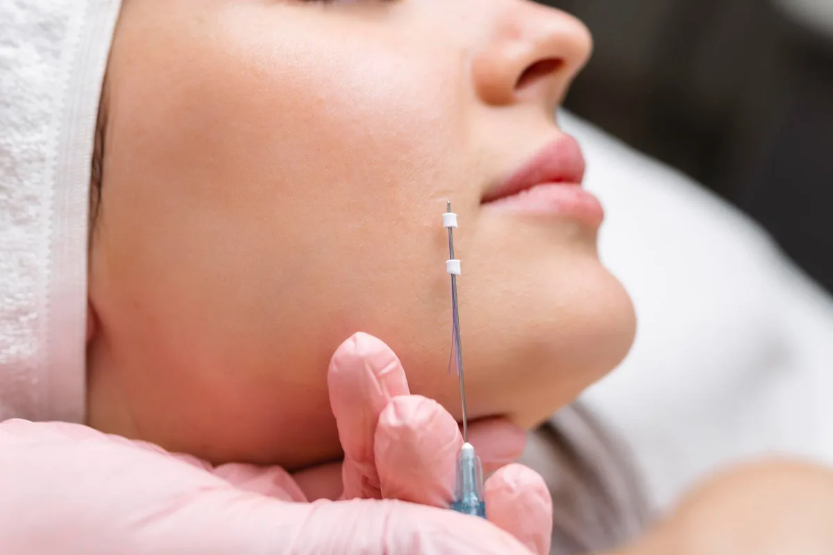 Preparing for and Recovering from a PDO Thread Lift