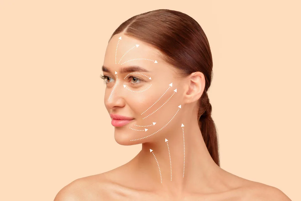 PDO Threads and Collagen Stimulation