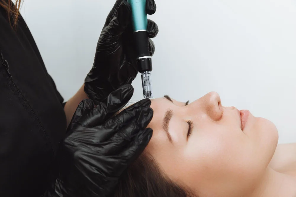 Your Complete Microneedling Guide: Do's and Don'ts
