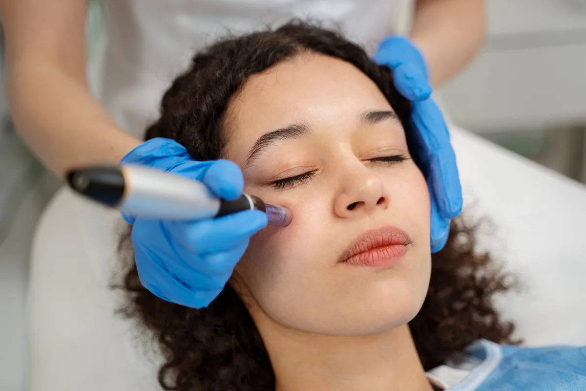 How Many Microneedling Sessions Do I Need?