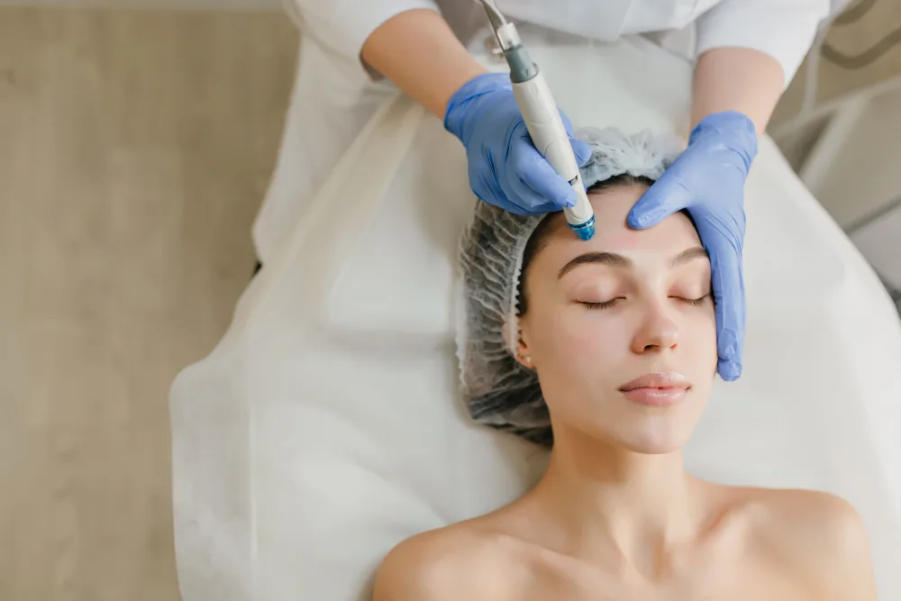 How Microneedling Supercharges Your Skincare Routine