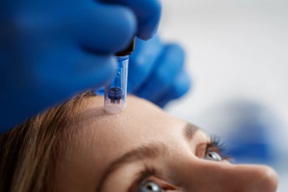 Everything You Need to Know About Microneedling Before Trying It