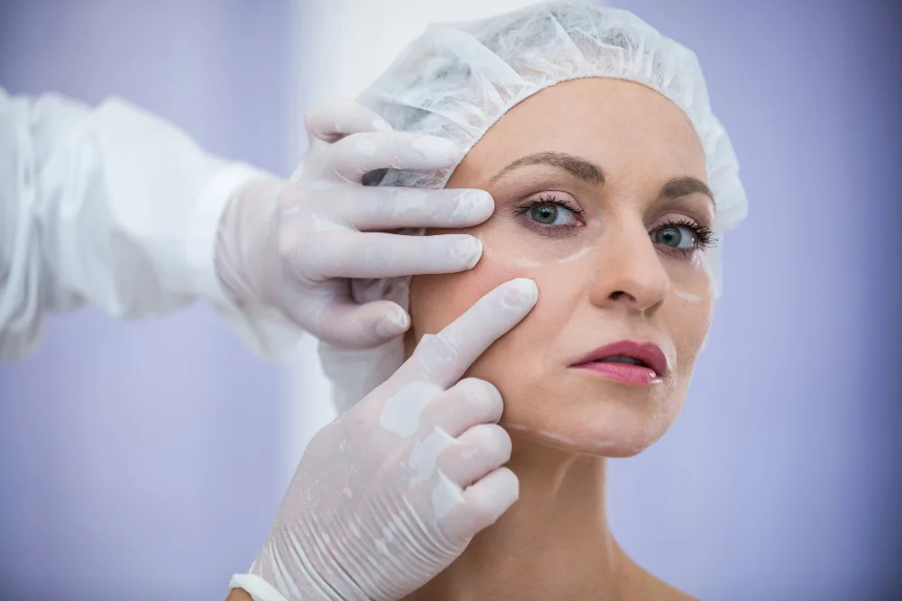 Myths About PDO Thread Lifts Debunked