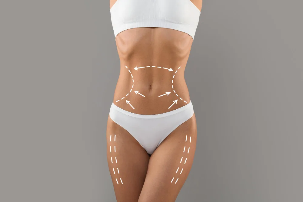 Liquid Lipo: Timeline to Transformation