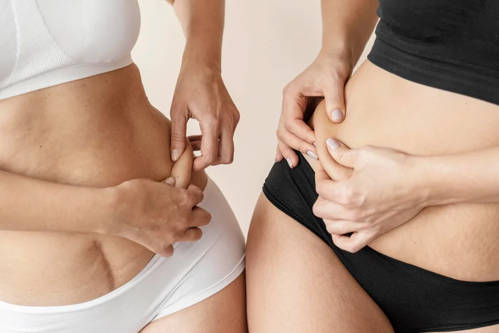 Liquid Lipo vs. Traditional Liposuction: Key Differences