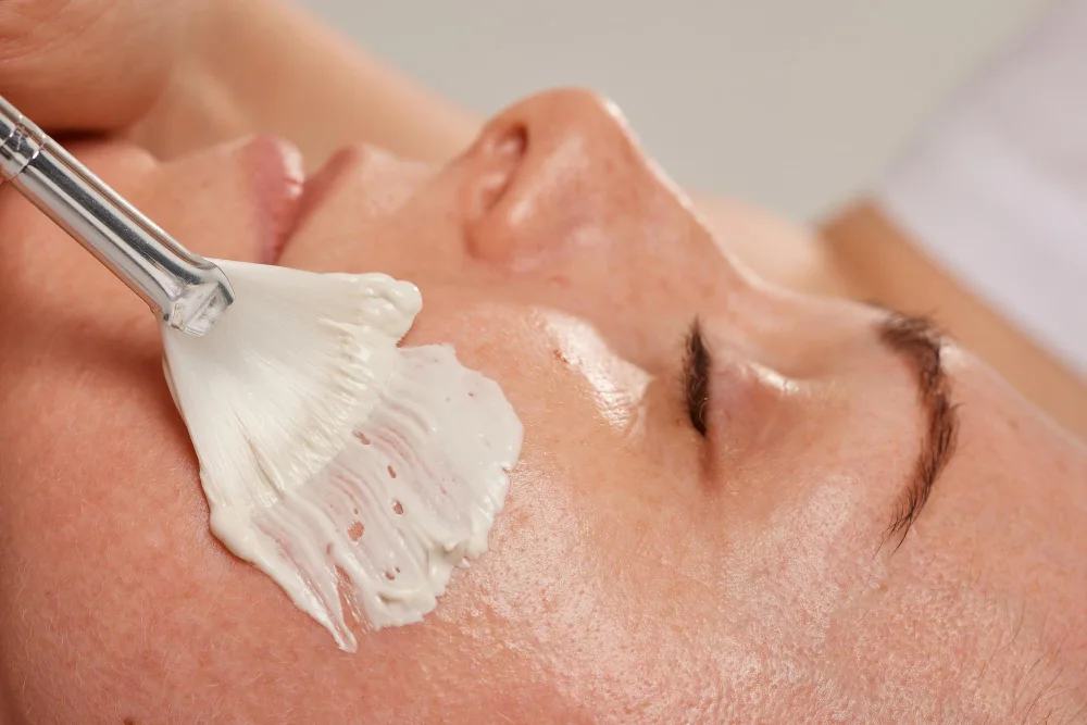 Getting Your Skin Chemical Peel-Ready