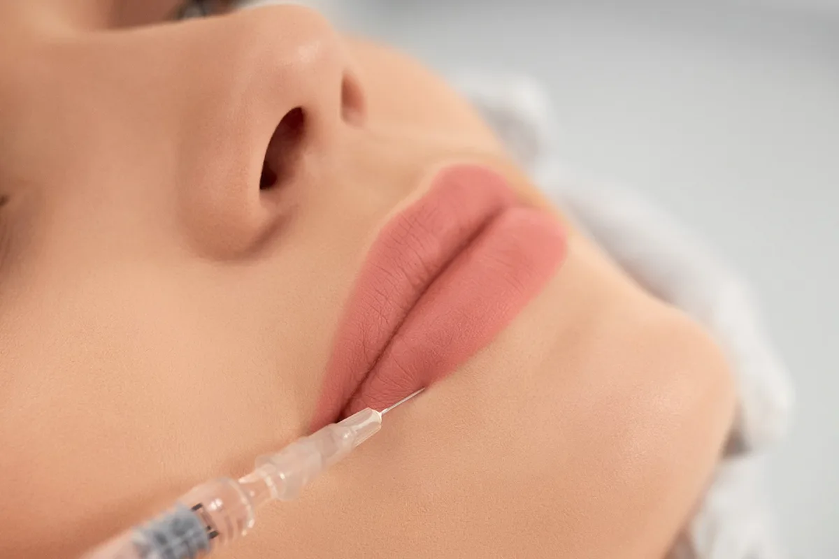 What You Need to Know Before Getting Lip Fillers
