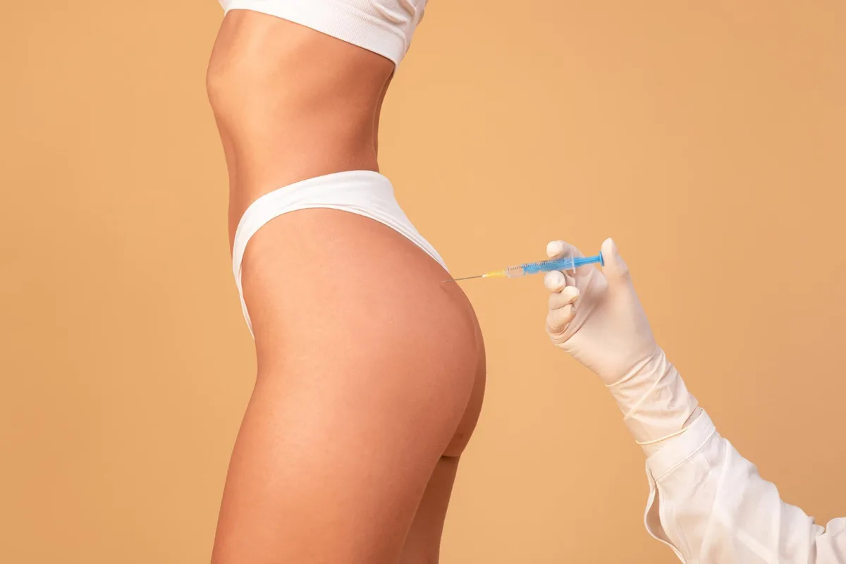 Where is Sculptra Injected?