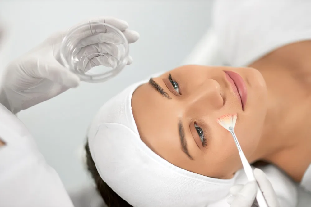 What to Expect During Chemical Peel Recovery: A Complete Guide
