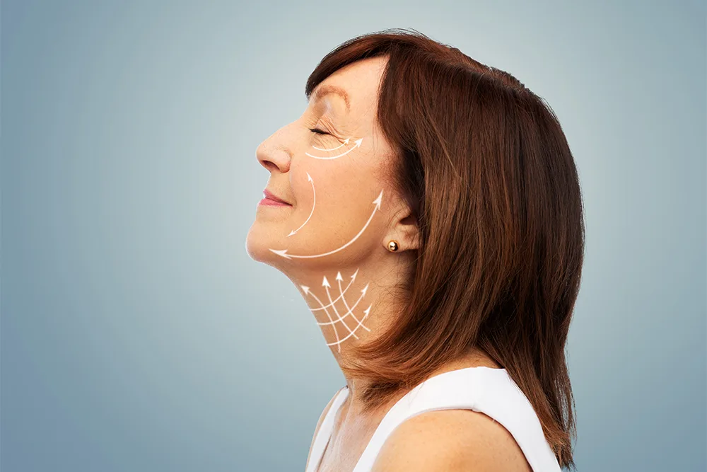 PDO Threads Show Promising Results for Skin Rejuvenation