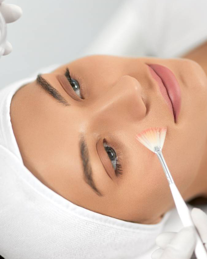 Chemical Peel Treatment