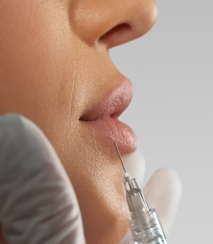 Dermal Filler Treatment